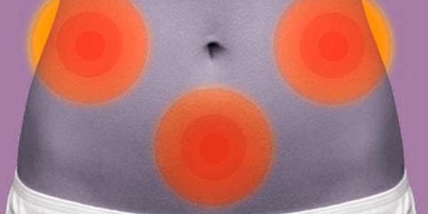 anticonceptivos hormonales, imagen dolor abdominal